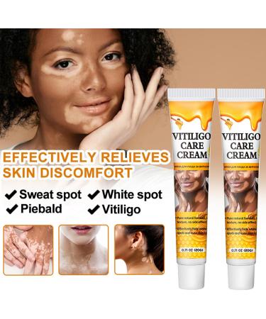 Crsetmyth Vitiligo Care Cream Skin Lightening and Repair Treatment 50ml - Buy Online on GoSupps.com