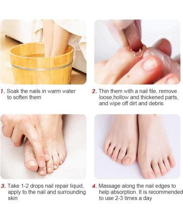 Nail Strengthening Treatment for Damaged Nails Nail Polish Strengthener Nail Hardner Oil Clear Nail Polish Strengthening Nail Growth and Strengthener Extreme Strength Nail Serum Nail Repair Serum - Buy Online on GoSupps.com