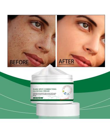  homomdy Set of 2 brightening creams to correct dark spots facial spot remover brighten and lighten skin moisturize brighten skin and repair the face - Buy Online on GoSupps.com