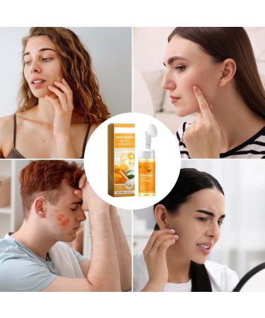 Turmeric Facial Cleanser | 100 ml This turmeric cleanser deeply cleanses the skin moisturizes and brightens without drying it out. - Buy Online on GoSupps.com