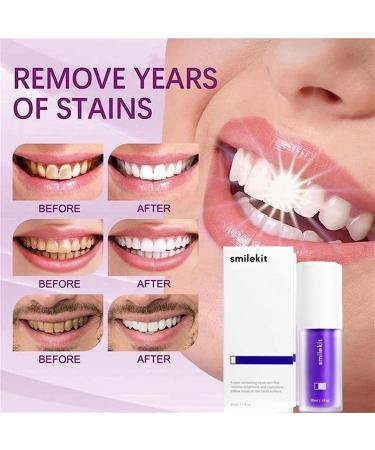 Smilekit Purple Toothpaste Series - Color Corrector & Teeth Whitening (2PCs) | International Shipping Available - Buy Online on GoSupps.com