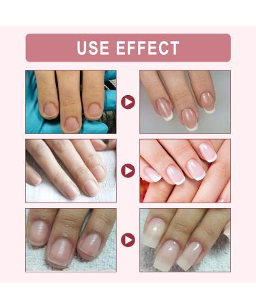 Nail Repair Gel - Instant Cracked Nail Treatment for Broken Nails - Strengthens and Repairs Natural Nails - Nail Extension Sculpture Gel (20ml) - Buy Online on GoSupps.com