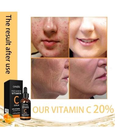 Tongyend Vitamin C Face Serum 20% Vitamin C Serum for Face Organic Vitamin C Anti Aging Serum for Face Collagen Serum for Face Fades Dark Spot Boost Skin Collagen Hydrate & Brighten - Buy Online on GoSupps.com