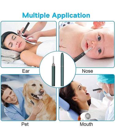 SMSOM Ear Wax Removal Tool with Camera Wireless Ear Wax Remover Otoscope with LED Light Endoscope Ear Pick Safe Ear Wax Removal Kit for Adults Kids &Pets (Color : C) - Buy Online on GoSupps.com