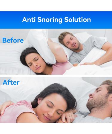 Buy Anti-Snoring Mouth Guard Blue - Effective Sleep Solution for Better Rest | Free International Shipping - Buy Online on GoSupps.com