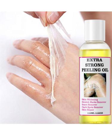 Yellow Peeling Oil - Lightening Exfoliating Dark Skin For Body Strong Peeling Oil Skin Peeling Oil For Skin Lightening Peeling Oil For Skin Brightening Moisturizing Peeling Solution Dark Skin