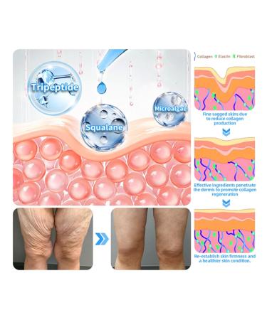 Fivfivgo Ultra Firming & Revitalizing Cream Advanced New Fivfivgo Skin Firming Cream Body Lotion Moisturizer Face Lotion & Body Cream-Renew Skin Firmness for All Skin Types (1Bottle 60ml) 1Bottle 2.02 Fl Oz (Pack of 1) - Buy Online on GoSupps.com