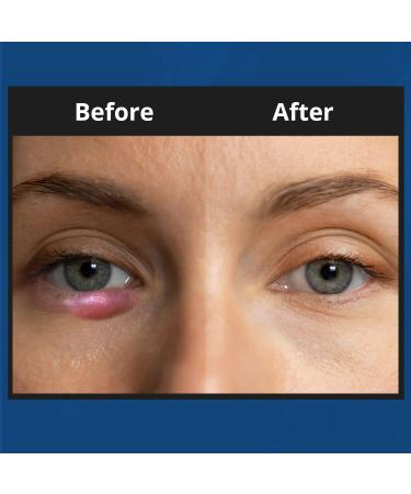 NOVEHA XStye Eyelid Foaming Cleanser - Fast Stye Eye Relief - Formula With Tea Tree Oil - Daily Eyelid and Eyelash Wash For Stye Eyes, Eyelash, & Skin Dryness (3.38 fl oz) - 100mL - Buy Online on GoSupps.com