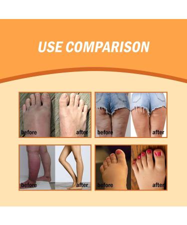 Gingerlegs Anti-Swelling Ointment Det_oxing Anti-Swelling Ointment Lymphcare Ginger Anti-Swelling Pomade Natural Lympunclog Ointment - Buy Online on GoSupps.com