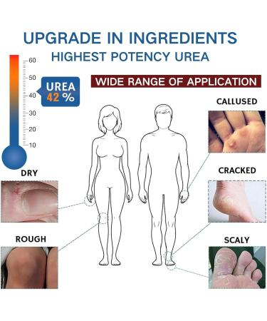 42% Urea Cream - Cracked Heel Repair Cream - Urea Foot Cream for Cracked Heels and Dry Skin - Foot Cream - Skin Care for Feet Heels Hands Knees Legs Toenails - Foot Moisturiser - Buy Online on GoSupps.com