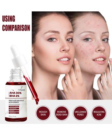 Fruit Acid Salicylic Acid Essence Fruit Acid Serum Salicylic Acid Serum Salicylic Acid Acne Treatment to Rejuvenate Skin Remove Acne Control Oil and Shrink Pores 30ml - Buy Online on GoSupps.com