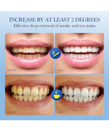  Nurvidis Whitening Toothpaste Whitening Toothpaste 2 Whitening Toothpastes Soft Mint Toothpaste Removes Tobacco Stains Coffee Stains Tea Stains and Yellow Teeth (A) - Buy Online on GoSupps.com