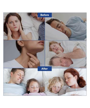 120pcs Anti Snoring Mouth Tape Strips for Better Sleep - Reduce Snoring & Mouth Breathing, Develop Nasal Breathing Habits - Buy Online on GoSupps.com