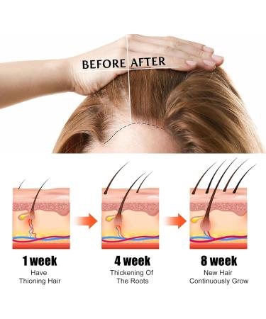 Castor Oil for Hair - Castor Oil Cold Pressed | Natural Hair Growth Oil with Castor | Strengthening Nourishing Hair Regrowth Oil | Hair Thickening Oil 30ml Promotes Longer Thicker Hair - Buy Online on GoSupps.com