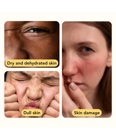 Snail Mucin 96% Power Repairing Essence | Hydrating Serum for Dull Skin & Fine Lines | Korean Skincare 100ml - Buy Online on GoSupps.com