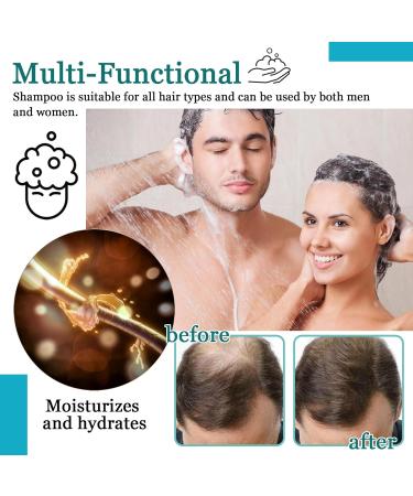 Cleansing Hair Shampoo for Men & Women | Oil Control & Hydrating Shampoo for All Hair Types - Shop Internationally - Buy Online on GoSupps.com