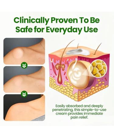 Luhaka Knot Removal Cream Deep Moisturizing Safe and Nourishing Formula (1PCS) - Buy Online on GoSupps.com