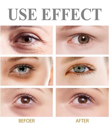 60-Second Age Defying Tinted Firming Gel | Instant Eye Tightener & Anti-Aging Cream - Reduce Wrinkles & Skin Problems (5 PCs) - Buy Online on GoSupps.com