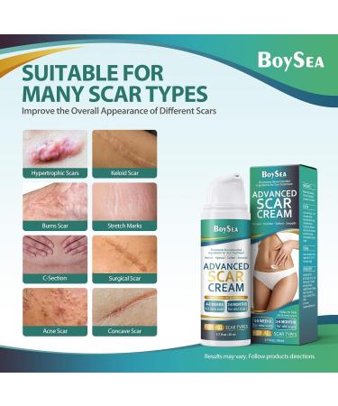 Buy Advanced Scar Cream - 1.76 oz | Effective Treatment for Keloids C-Section Surgery Burns & Acne | Fast Fading for Old/New Scars - International Shipping Available - Buy Online on GoSupps.com