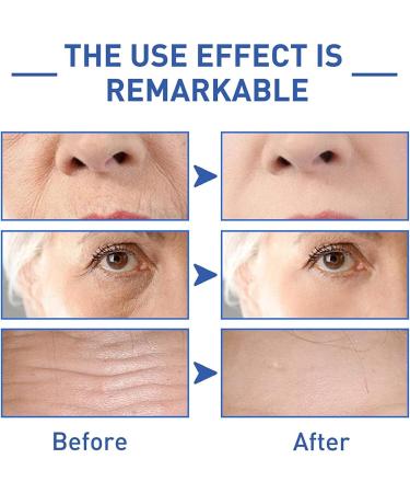 Cono Peptide Essence 84% Effective Anti-ageing 30ml Cono Peptide Essence Anti-Aging Wrinkle Serum Instant Lifting Face Skin Care Reduce Pigmentation And Fine Lines for all of Skin (3pcs) - Buy Online on GoSupps.com