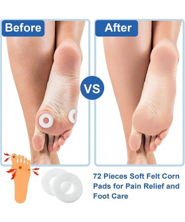 Corn Callus Pad | Soft Felt Cushion for Soreness Relief - Adhesive & Portable - Buy Online on GoSupps.com