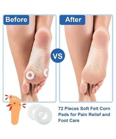 12 Sheet Soft Adhesive Foot Callus Cushions for Soreness Relief and Pressure Reduction - Round Corn Pads for Foot Care - Buy Online on GoSupps.com