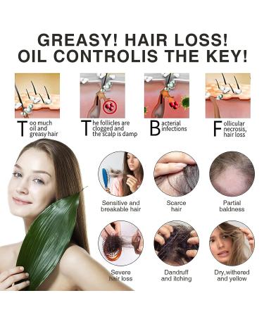 Organic Polygonum Multiflorum Ginger Hair Growth Shampoo Bars - Anti Hair Loss & Anti-Dandruff - 2pcs Set - Buy Online on GoSupps.com