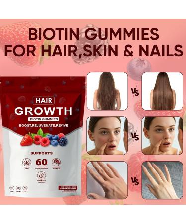 Neonomicon Lumin Hair Growth Gummies with Biotin Vitamin C & E Rosemary Saw Palmetto Supports Healthy Hair Growth & Strength Skin & Nail Care Mixed Berry Flavor 60 Gummies (1) - Buy Online on GoSupps.com