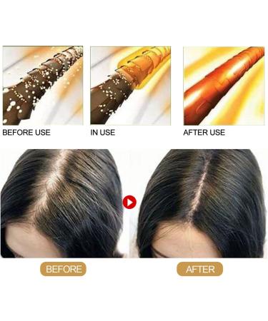 2 Soap Shampoo Soap Natural Shampoo for Anti-Hair Loss for Hair Growth for Hair Growth - Buy Online on GoSupps.com