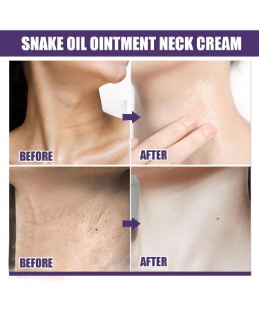 Instant Effects Neck Firming Cream - Anti Aging Retinol Moisturizer for Tightening Sagging Skin - Neck & Chest Lift Formula - Buy Online on GoSupps.com