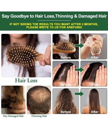 Hair Growth Shampoo and Conditioner Sets w/6 in 1 Heat Protectant Spray Rosemary Oil Biotin Keratin Caffeine Sulfate Free Hair Thickening Products for Thinning Hair & Hair Loss Gifts for Women Men - Buy Online on GoSupps.com