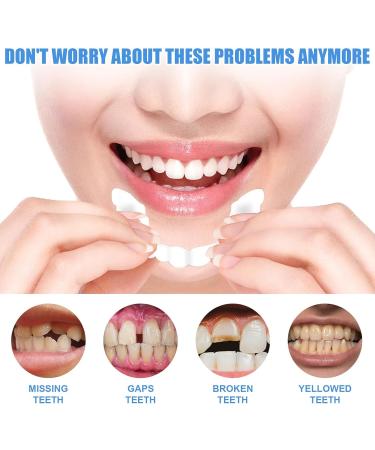 Buy 2 Pairs Instant Veneer Prostheses - Comfortable & Natural Fake Teeth for Men & Women | Artificial Teeth Solutions - Buy Online on GoSupps.com