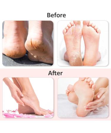 Dexspoeny 2Pairs Silicone Moisturizing Socks & Gloves Silicone Gel Glove and Sock for Foot Hand Softening Calluses Foot Care After Pedicure Suitable for Most Sizes(Beige) - Buy Online on GoSupps.com