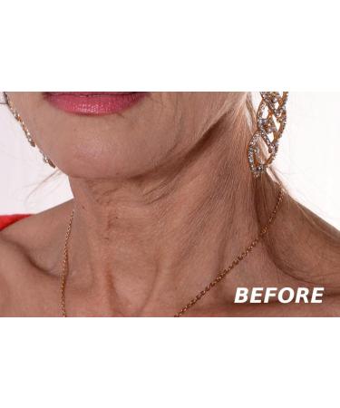 Nexsey Neck Tape - Lift, Tighten and Smooth Sagging Skin, Wrinkles, and Double Chin - Buy Online on GoSupps.com