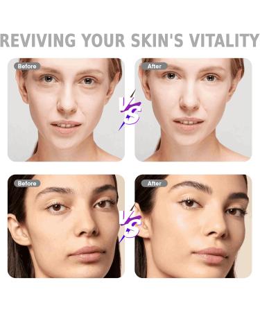  TopDirect Pack of 10 replacement 36-pin microneedling cartridges for Dr.pen Ultima A6/A10 Derma Pen Derma Roller tips bayonet slot 10 units/pack - Buy Online on GoSupps.com