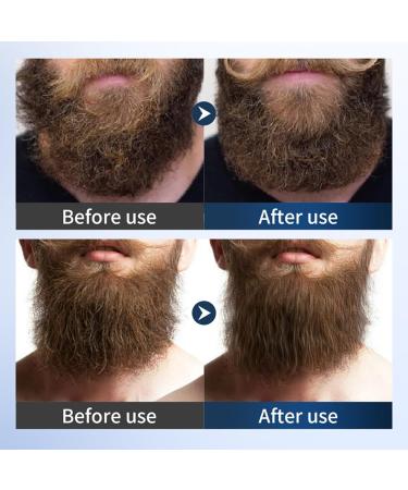 Baume Adoucissant Pour Barbe - 2 Pi ces | Huile D'argan & Jojoba Pour Barbe Douce Et Hydrat e | Pour Stylage Et Nutrition | Brillance Contr le Des Frisottis Et paississement De La Barbe - Buy Online on GoSupps.com