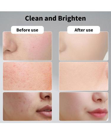 Jungshea Resurfacing Pad Glycolic Acid Pads for Face: Facial Exfoliating Cleansing Peel with Salicylic Acid & Vitamins B5 C E - Korean Skin Care Face Peeling Wash Wipes - Buy Online on GoSupps.com