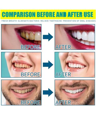 Natural Coconut Oil & Peppermint Mouthwash for Fresh Breath & Healthy Teeth | Long-Term Oral Care - Buy Online on GoSupps.com