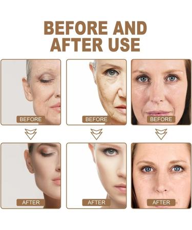(100% 5 star) Rapid Anti Wrinkle Cream Wrinkle Filler for Deep Wrinkles Instantly | Wrinkle Cream for Men and Women | Wrinkle Cream | Deep Wrinkle Cream | Anti Wrinkle Face Cream | Anti Aging Cream - 50ml/1.7fl.oz (2pcs Rapid Anti Wrinkle Cream) - Buy Online on GoSupps.com