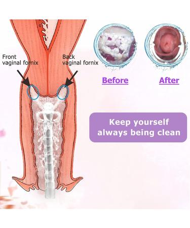 300ml Vaginal and Anal Douche Cleaner Kit - 3 Nozzle Tips, Reusable Manual Enema for Water Colon Cleansing - Perfect Gift for Women (300ml/10.1oz) - Buy Online on GoSupps.com