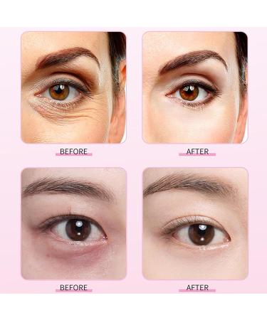 Firming Eye Serum Mango Revitalizing Eye Cream Anti-Wrinkle Anti-Aging Moisturizing and Smoothing Eye Cream - Buy Online on GoSupps.com