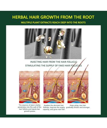  Facynde Facyn Ginger Hair Nutrient Solution Hair Oil for Hair 1floz Hair Oil for Dry and Damaged Hair Deep Moisturizing Conditioner for Growth - Buy Online on GoSupps.com