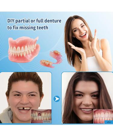 Kaimloyou DIY Denture Kit - Top & Bottom Fake Teeth with Comfort Fit for Everyday Use Natural-Looking Emergency Replacement Solution (Size fits Most People as it can be Adjustable) - Buy Online on GoSupps.com