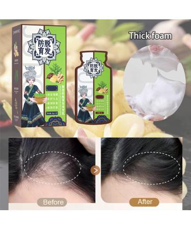 Ginger Plant Extract Anti-Hair Loss Hair Shampoo Ginger Plant Anti-Hair Loss Hair Shampoo Anti-Hair Loss And Hair Strengthening Shampoo Ginger Shampoo For Hair Growth - Buy Online on GoSupps.com