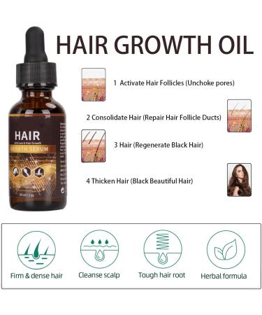 Hair Growth Oil Thinned Hair Liquid Grow Hair Deeply Nourishing Scalp Stimulates Hair Growth Trengthen Hair Roots Moisturize & Repair Dry Damaged Hair Care Hair Growth Serum for All Hair Types - Buy Online on GoSupps.com