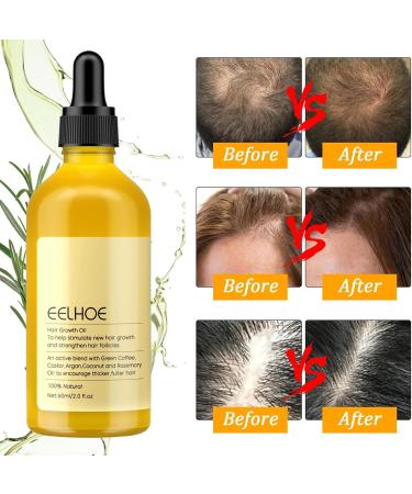  YHNMMNO Rosemary Oil for Hair & Scalp - Natural Hair Growth Oil with Organic Rosemary Oil Castor Oil Almond Oil & Argan Oil - 60ml - Buy Online on GoSupps.com