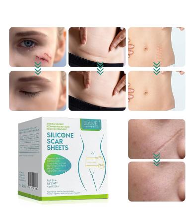 Silicone Scar Tape 1.6 x 60 Inch - Medical Grade Treatment for Surgery, C-Section, Keloid & Burn Scars - Safe & Painless Removal Strips - Buy Online on GoSupps.com