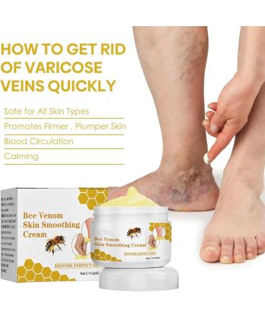 2024 New Bee Venom Varicose & Spider Veins Relief Cream for Legs Natural Varicose & Spider Veins Improve the Look of the Legs and Blood Circulation Tired and Heavy Legs Relief 60g/2.11fl.oz (3 Jars) - Buy Online on GoSupps.com