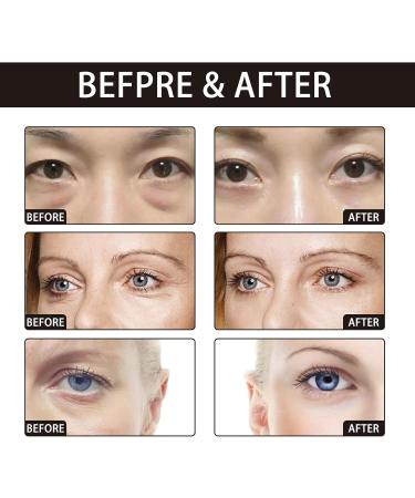  Grgowe 2Pack Retinol Moisturizing Cream The Ordinary Retinol Face Serum Retinol Essence Anti Aging Wrinkle Removal Skin Firming Cream Reduces Dry Wrinkles And Fine Lines - Buy Online on GoSupps.com