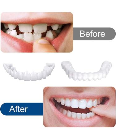 Giural 2-Piece Upper Teeth Denture - Temporary Anti-Real Prosthesis Reusable Adult Whitening Veneer for Comfortable Dental Care - Buy Online on GoSupps.com